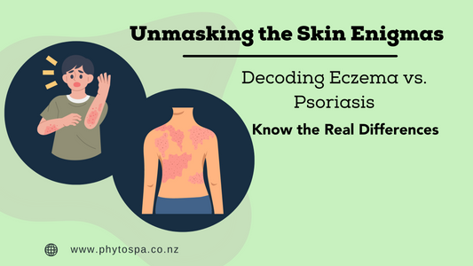 Unmasking the Skin Enigmas: Decoding Eczema vs. Psoriasis – Know the Real Differences
